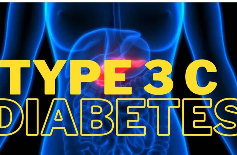 Type 3 diabetes: टाइप 3 डायबिटीज होती है सबसे खतरनाक, इन बातों का रखें ध्‍यान वरना हो जाएगी आफत